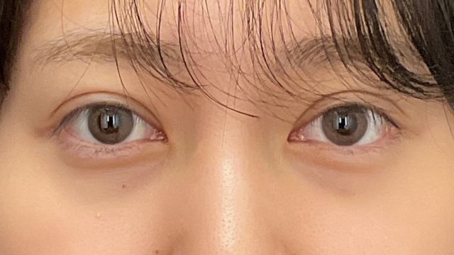 Postoperative Condition Part 1