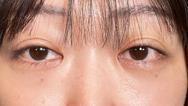 Postoperative Condition Part 1