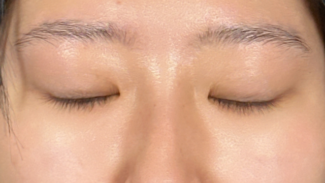 Postoperative Condition Part 1