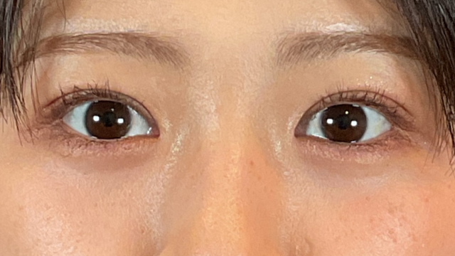 Postoperative Condition Part 1