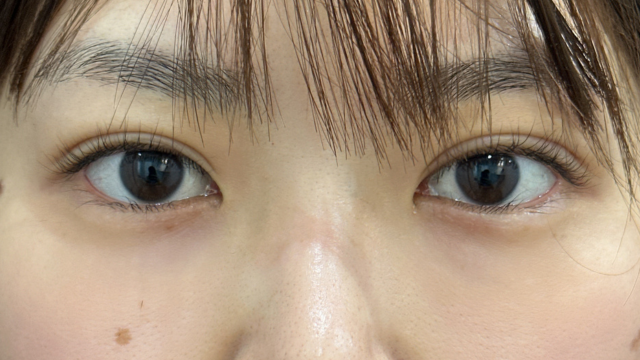 Postoperative Condition Part 1