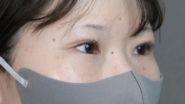 Postoperative Condition Part 1