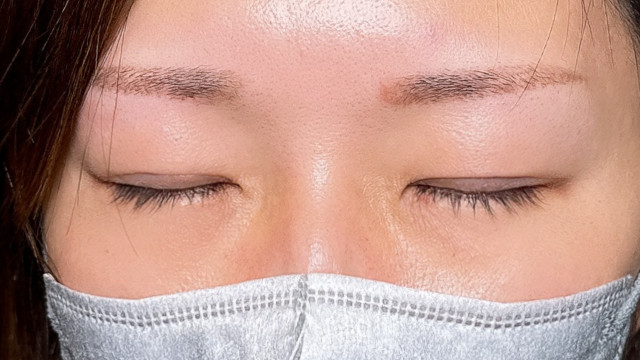 Postoperative Condition Part 1