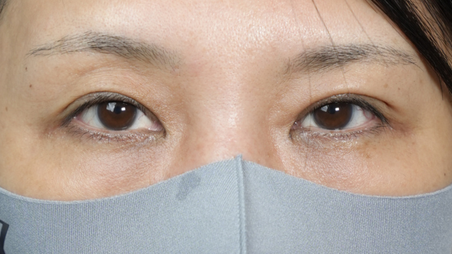 Postoperative Condition Part 1