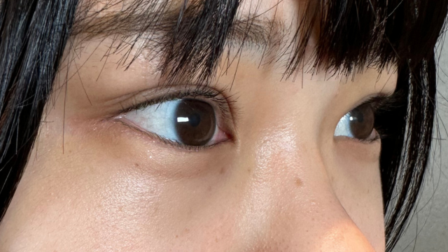 Postoperative Condition Part 1