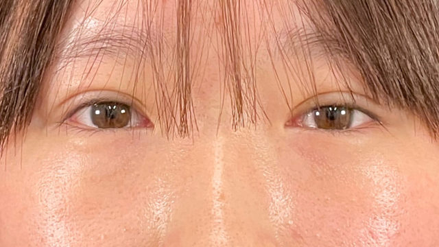 Postoperative Condition Part 1