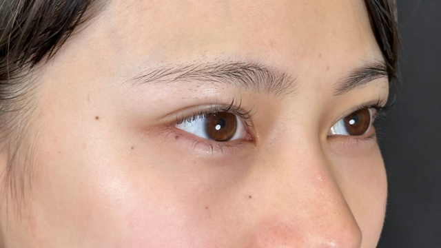 Postoperative Condition Part 1