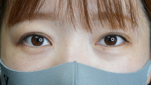 Postoperative Condition Part 1