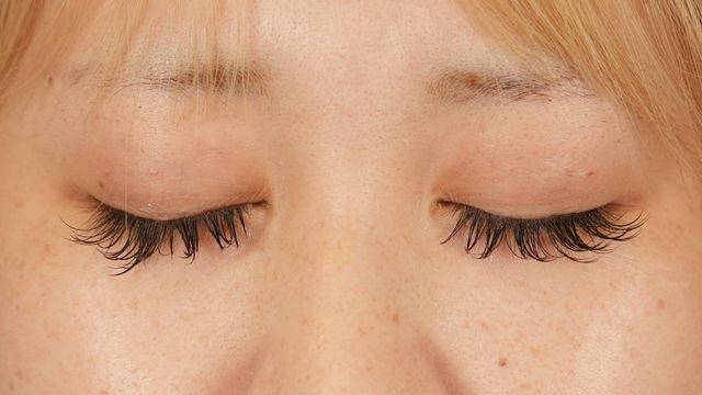 Postoperative Condition Part 1