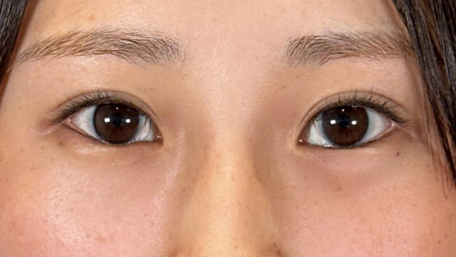 Postoperative Condition Part 1