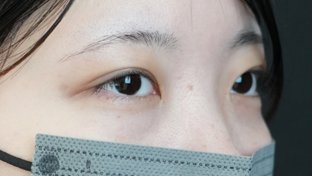 Postoperative Condition Part 1