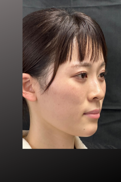 Postoperative Condition Part 1