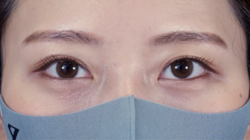 Postoperative Condition Part 1