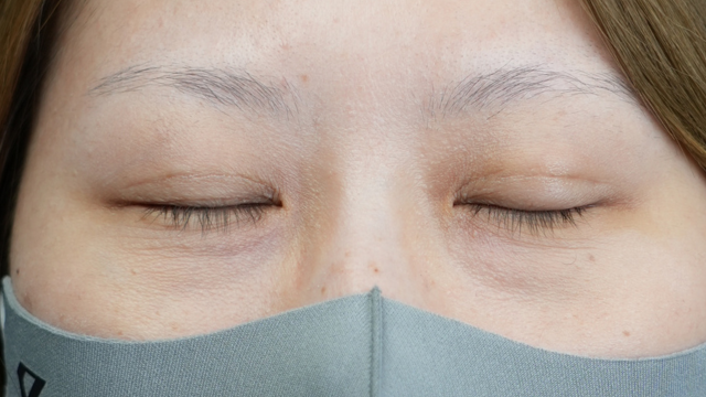 Postoperative Condition Part 1