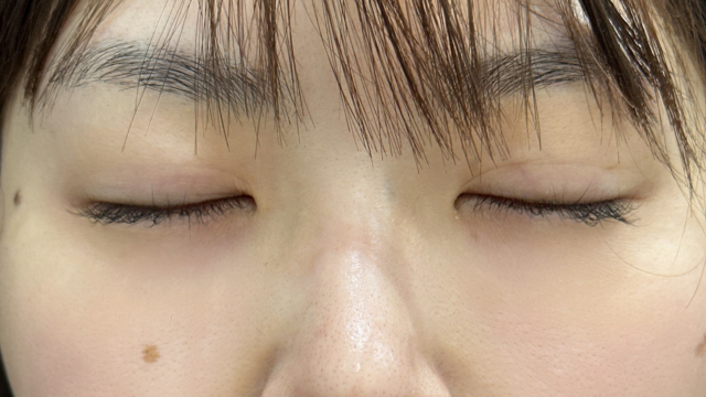 Postoperative Condition Part 1