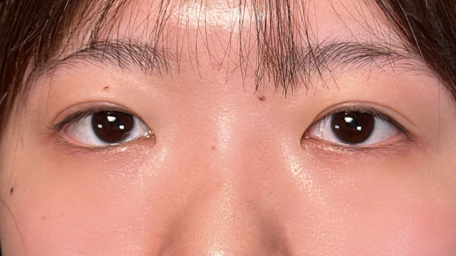 Postoperative Condition Part 1