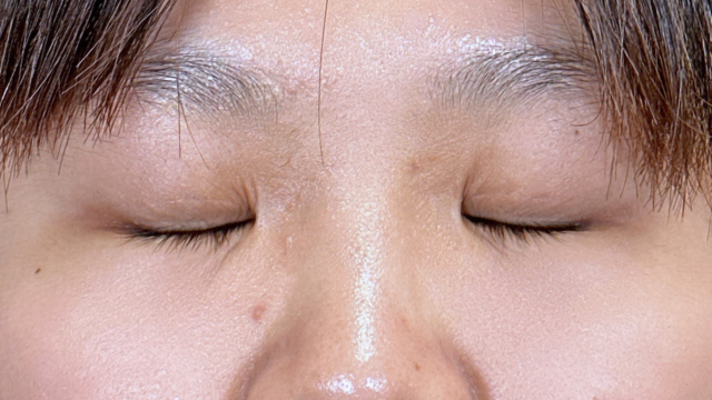 Postoperative Condition Part 1