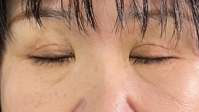 Postoperative Condition Part 1