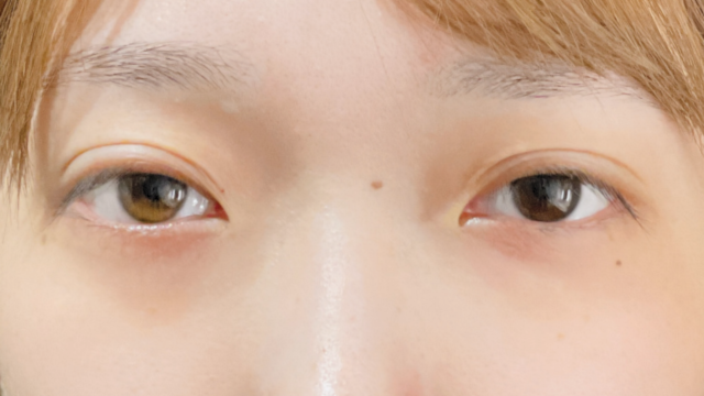 Postoperative Condition Part 1