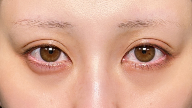 Postoperative Condition Part 1