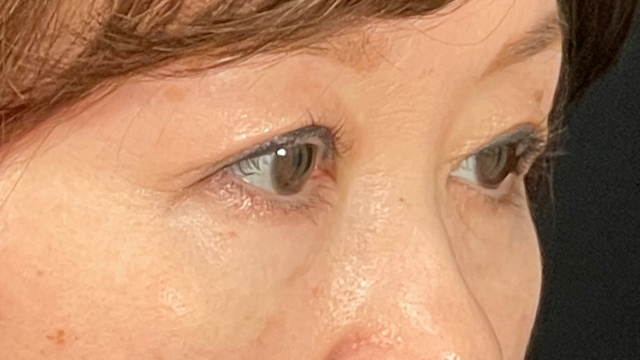 Postoperative Condition Part 1