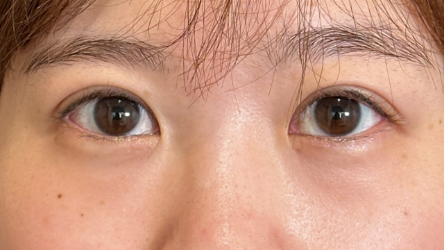 Postoperative Condition Part 1