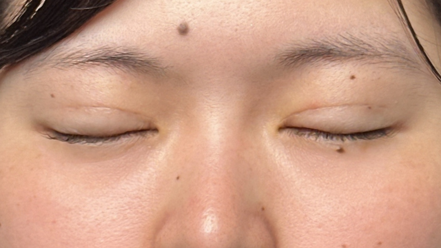 Postoperative Condition Part 1