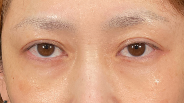 Postoperative Condition Part 1