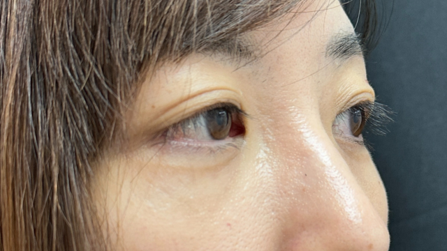 Postoperative Condition Part 1