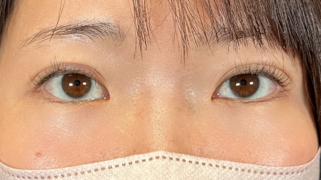 Postoperative Condition Part 1