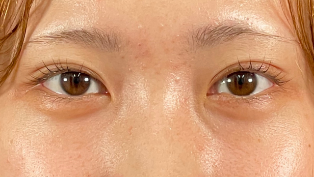 Postoperative Condition Part 1