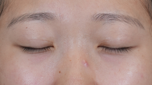 Postoperative Condition Part 1