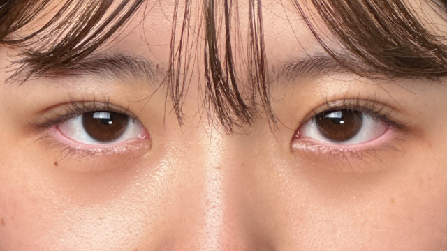 Postoperative Condition Part 1