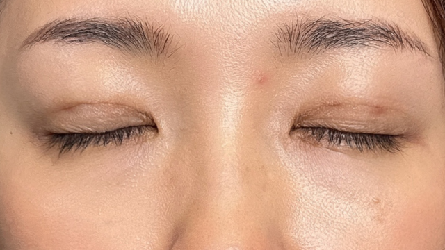 Postoperative Condition Part 1