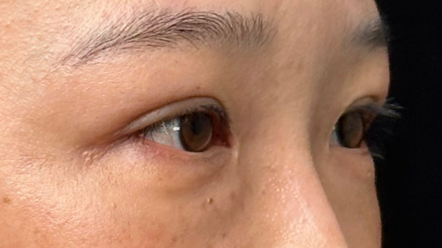 Postoperative Condition Part 1