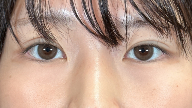 Postoperative Condition Part 1