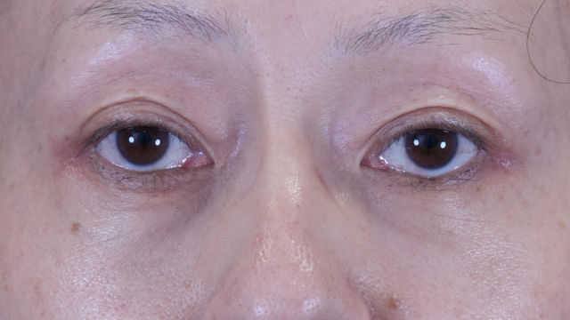 Postoperative Condition Part 1