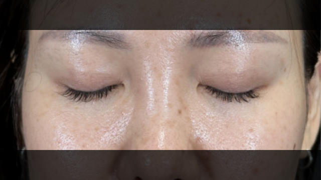 Postoperative Condition Part 1