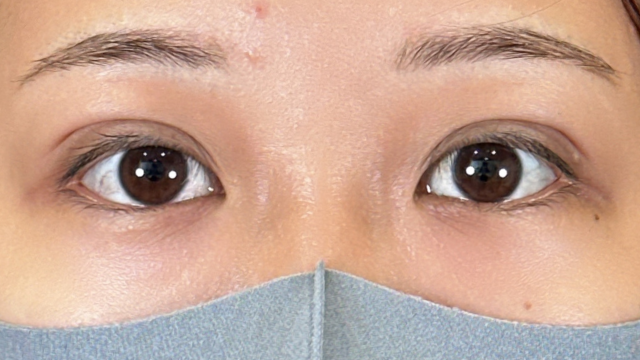 Postoperative Condition Part 1