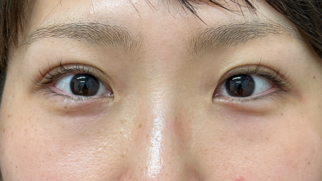 Postoperative Condition Part 1