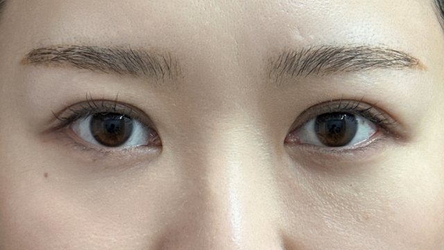 Postoperative Condition Part 1