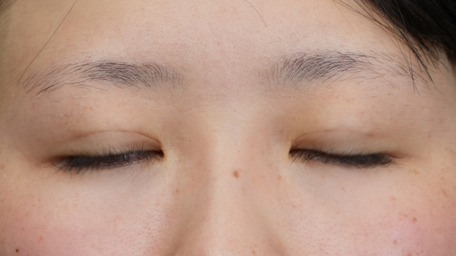 Postoperative Condition Part 1