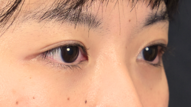 Postoperative Condition Part 1