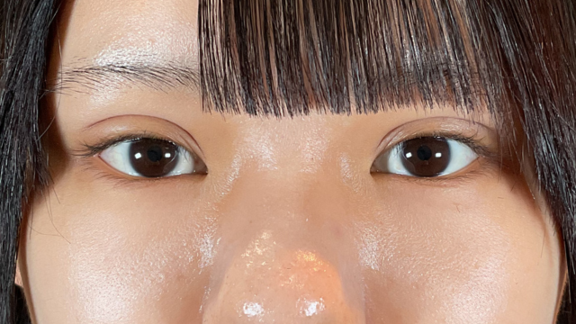 Postoperative Condition Part 1