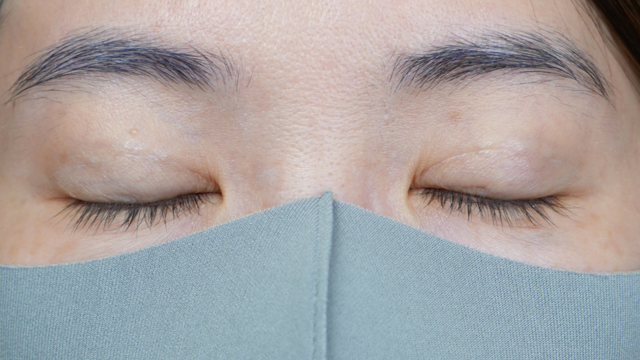 Postoperative Condition Part 1