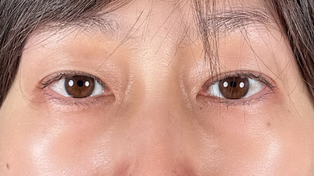 Postoperative Condition Part 1