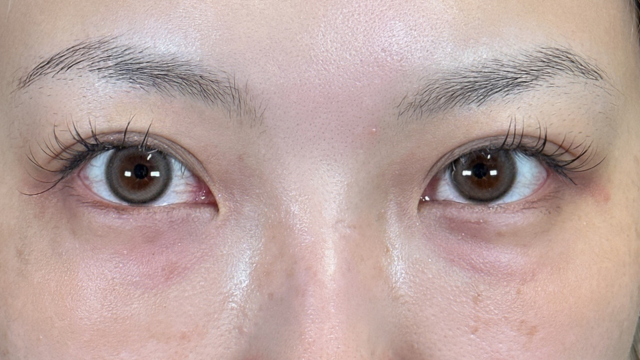 Postoperative Condition Part 1