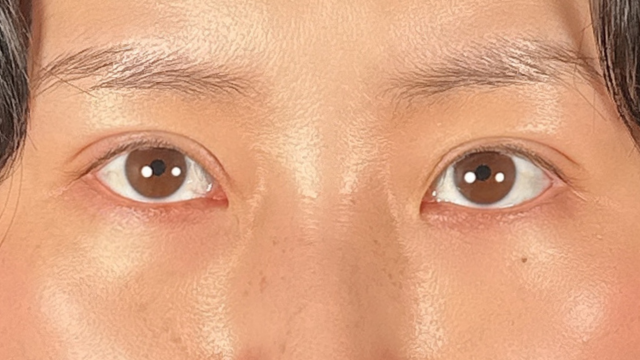 Postoperative Condition Part 1