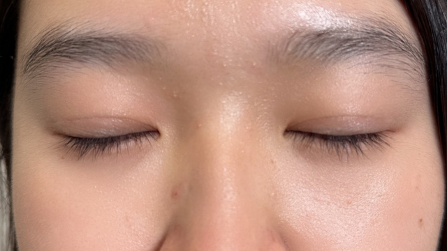 Postoperative Condition Part 1