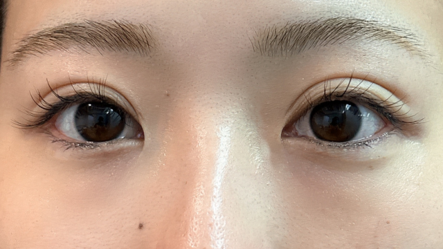 Postoperative Condition Part 1